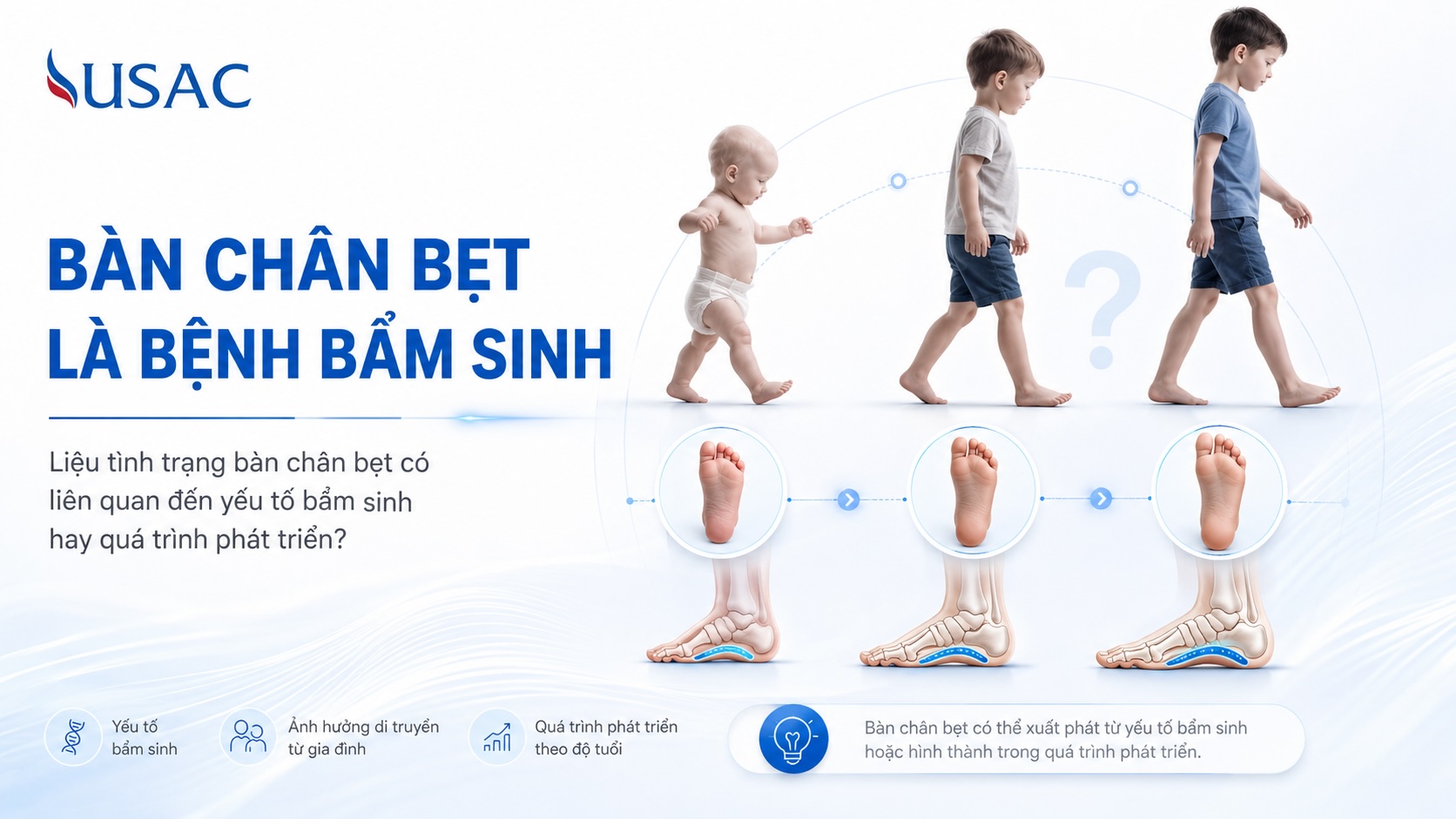 Bàn Chân Bẹt Là Bệnh Bẩm Sinh Bàn Chân Bẹt Là Bệnh Bẩm Sinh