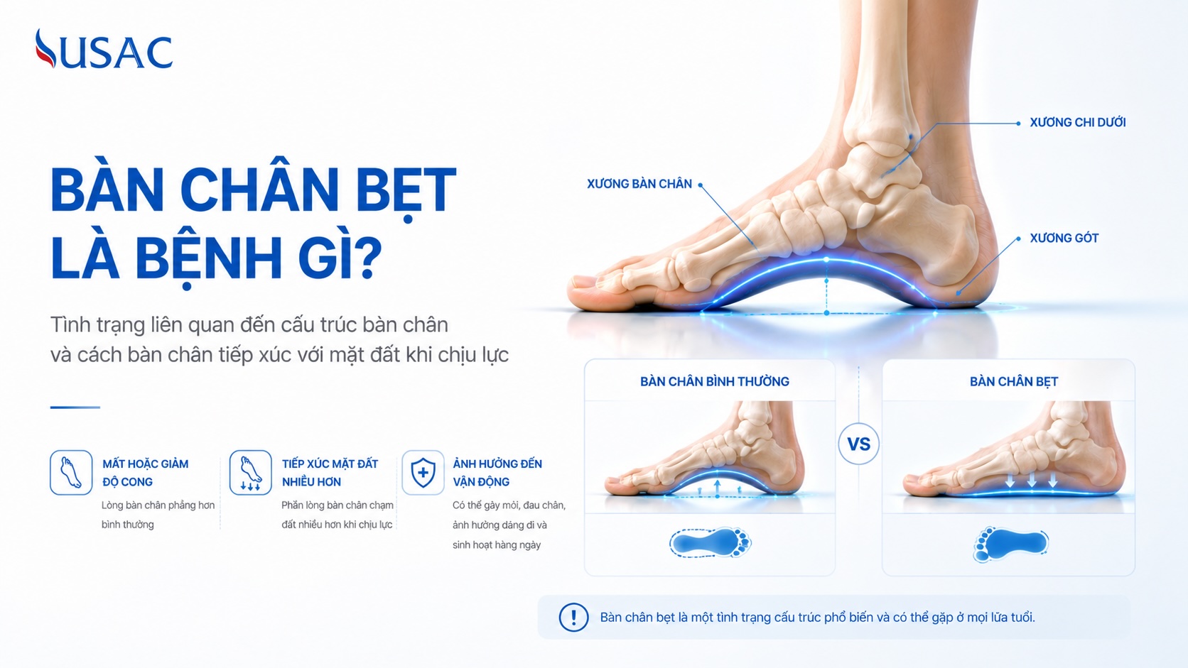 Bàn Chân Bẹt Là Bệnh Gì