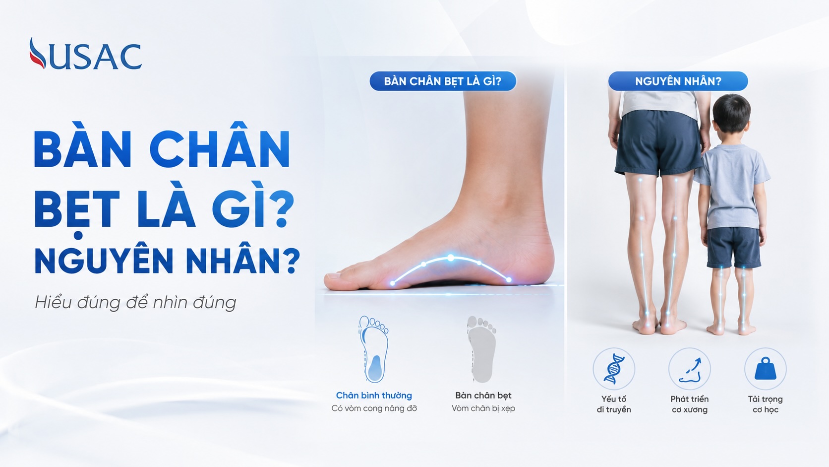 Bàn Chân Bẹt Là Gì Nguyên Nhân Bàn Chân Bẹt Là Gì Nguyên Nhân