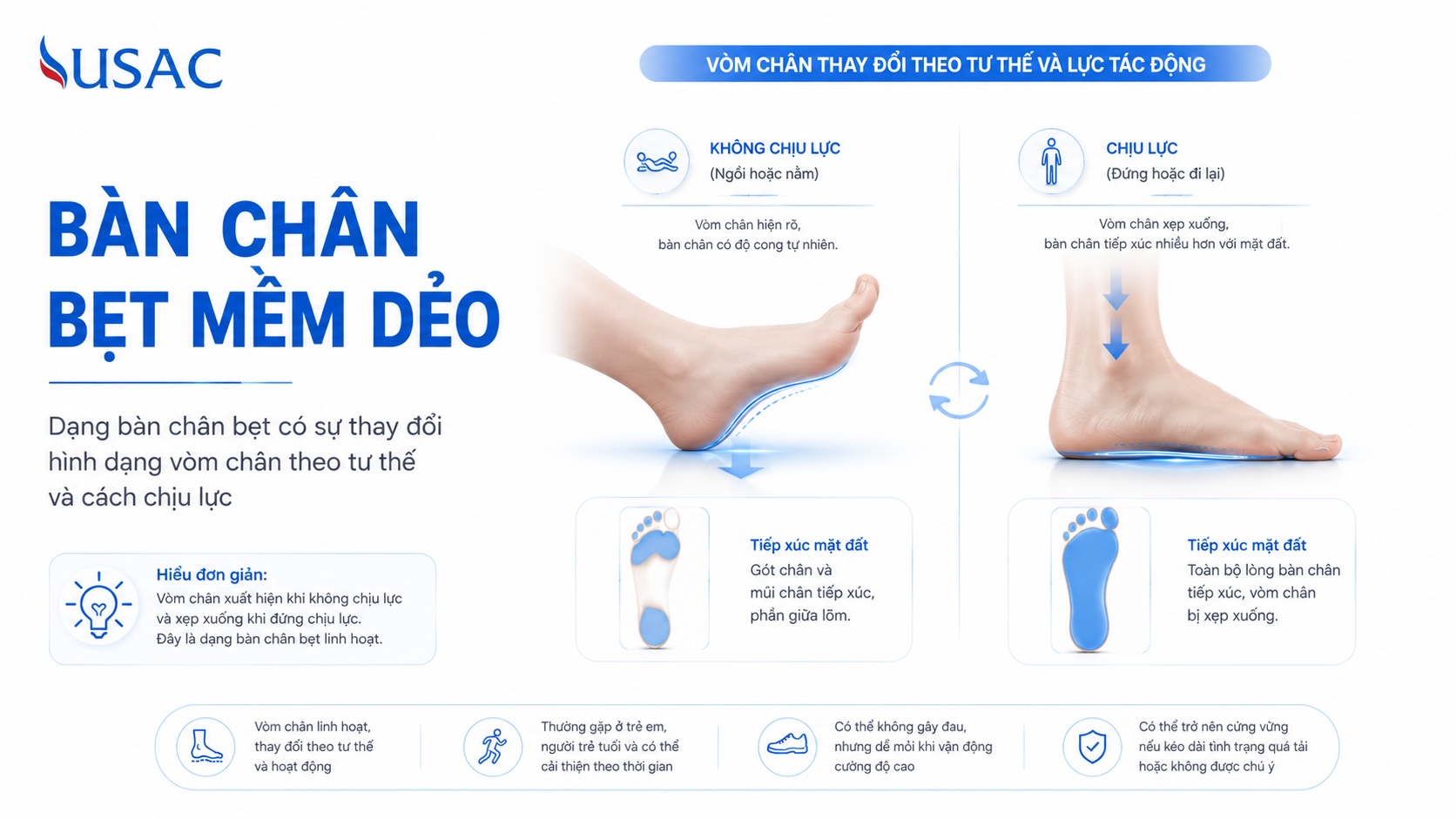 Bàn Chân Bẹt Mềm Dẻo Bàn Chân Bẹt Mềm Dẻo