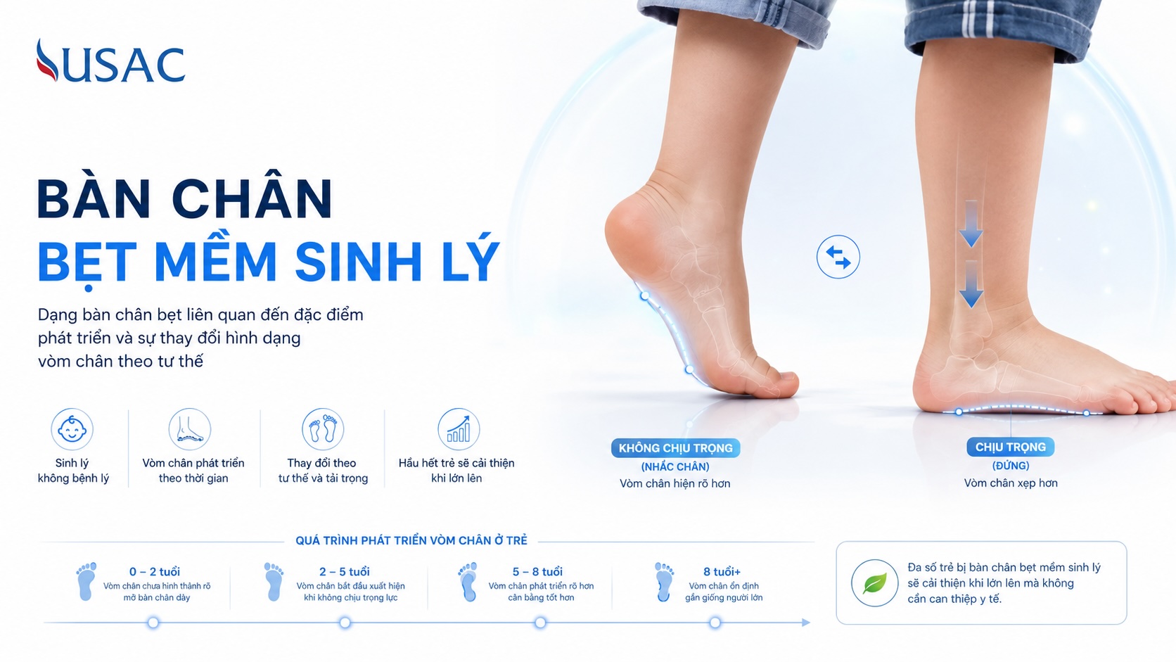 Bàn Chân Bẹt Mềm Sinh Lý Bàn Chân Bẹt Mềm Sinh Lý