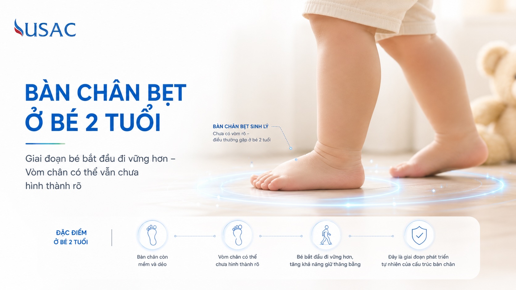 Bàn Chân Bẹt Ở Bé 2 Tuổi
