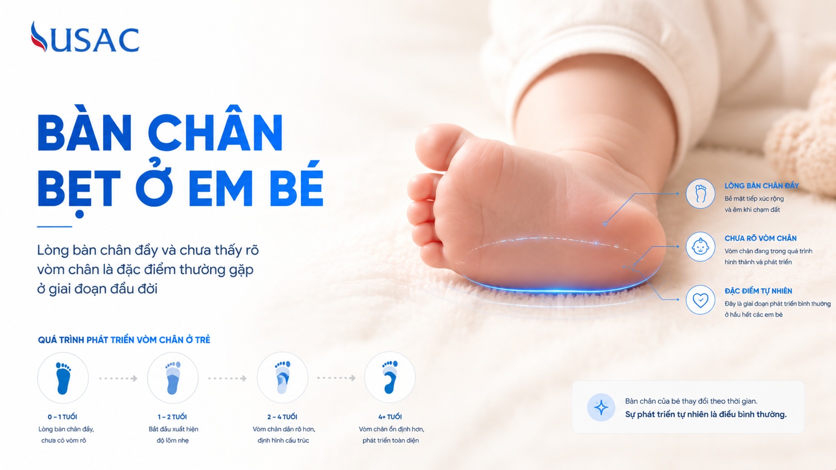 Bàn Chân Bẹt Ở Em Bé Bàn Chân Bẹt Ở Em Bé