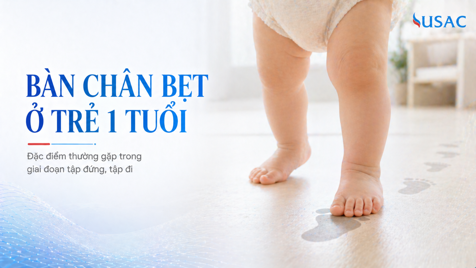 Bàn chân bẹt ở trẻ 1 tuổi Bàn chân bẹt ở trẻ 1 tuổi