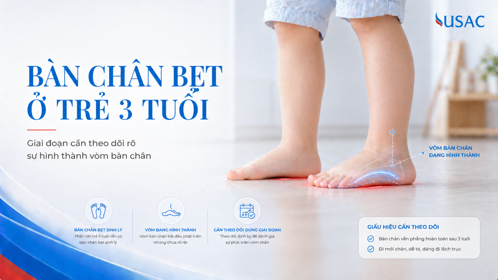 Bàn Chân Bẹt Ở Trẻ 3 Tuổi