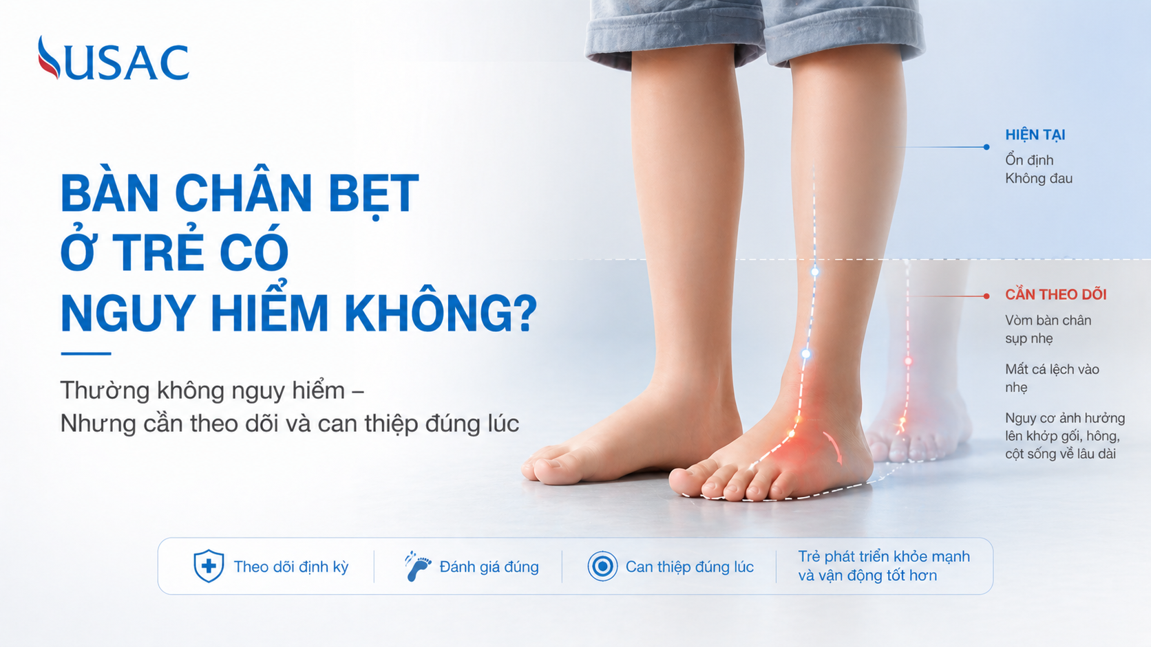 Bàn Chân Bẹt Ở Trẻ Có Nguy Hiểm Không