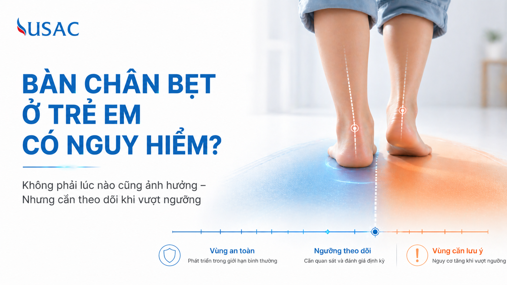 Bàn Chân Bẹt Ở Trẻ Em Có Nguy Hiểm