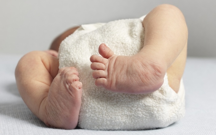 Bàn Chân Bẹt Ở Trẻ Sơ Sinh