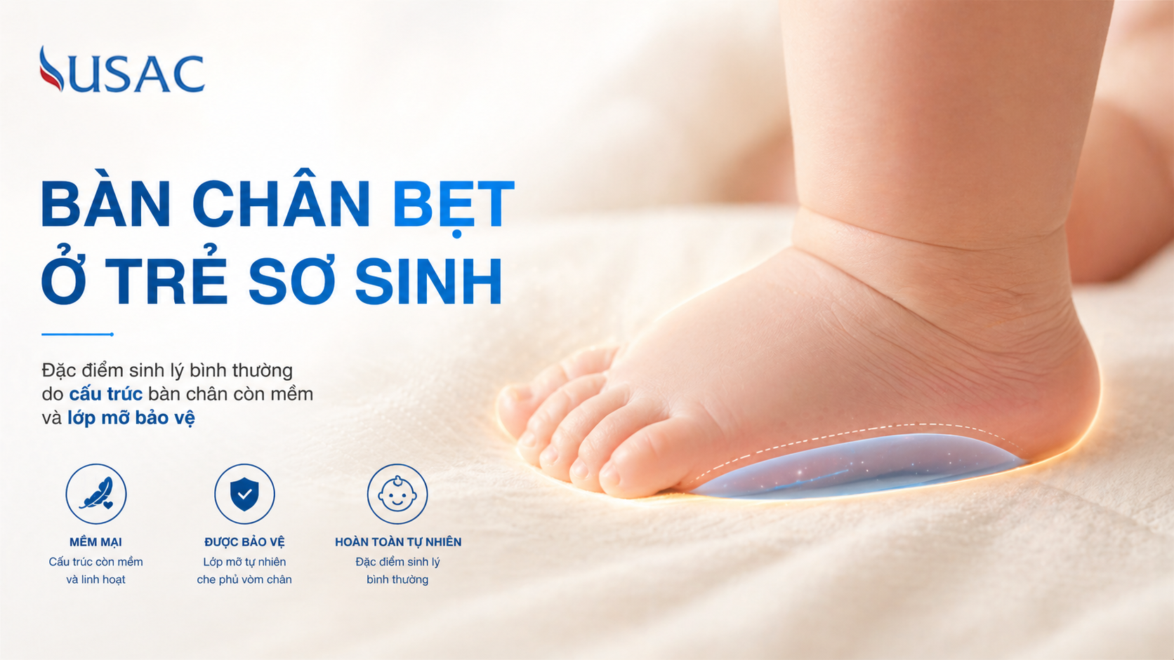 Bàn Chân Bẹt Ở Trẻ Sơ Sinh Bàn Chân Bẹt Ở Trẻ Sơ Sinh