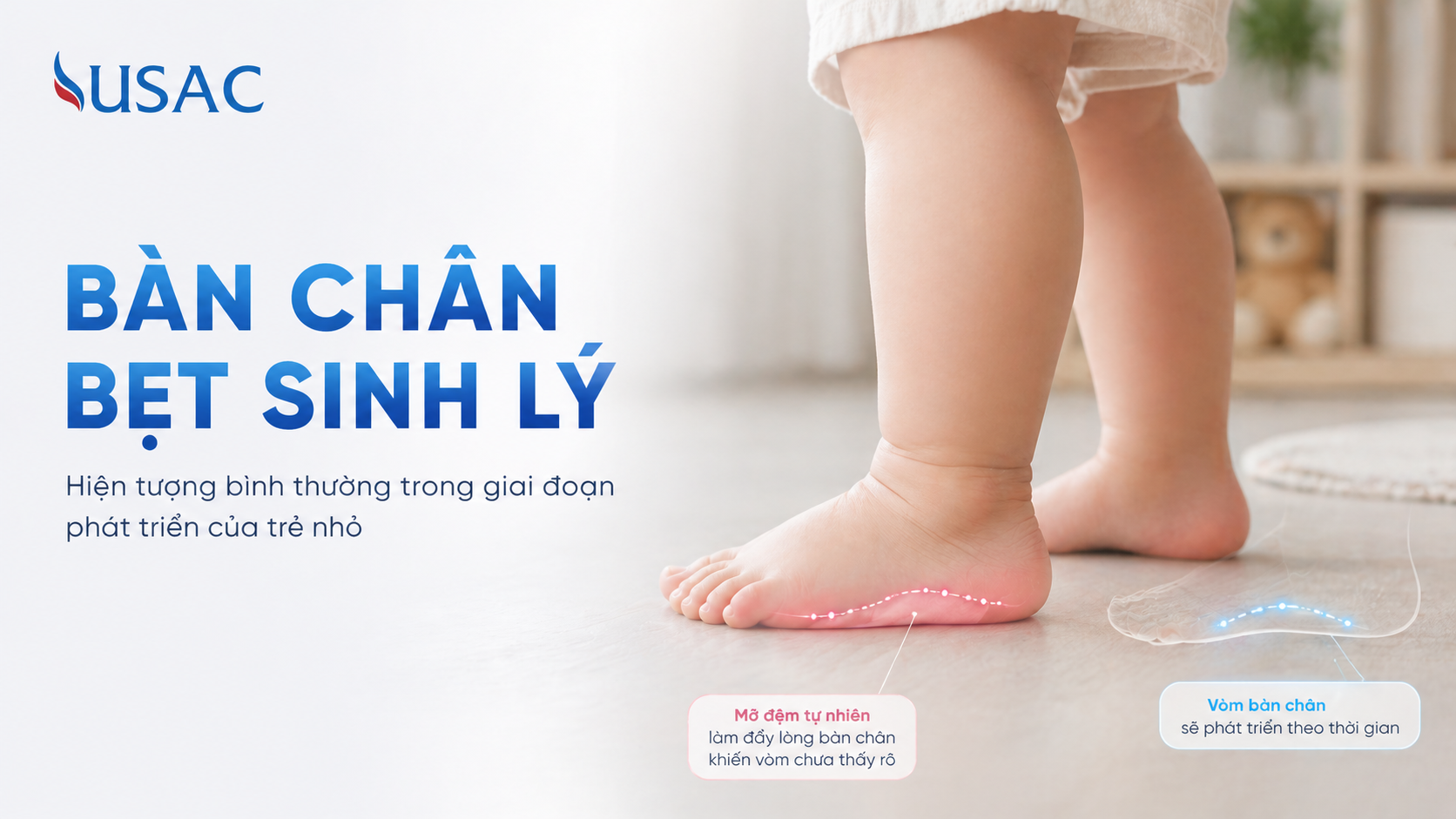 Bàn Chân Bẹt Sinh Lý