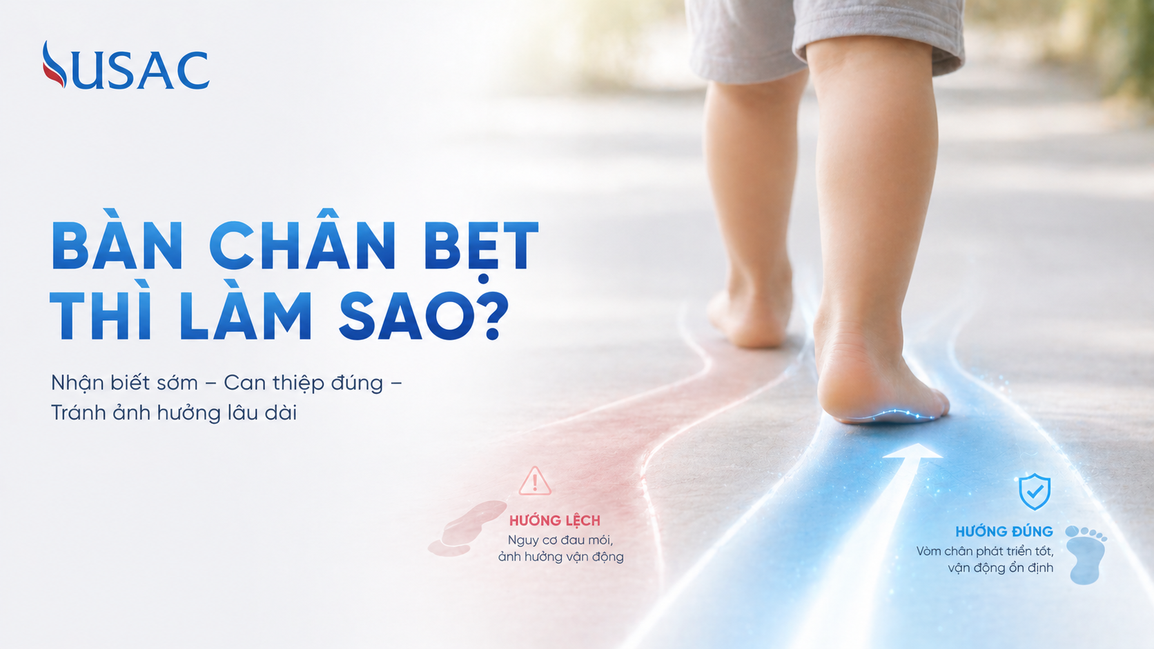 Bàn Chân Bẹt Thì Làm Sao