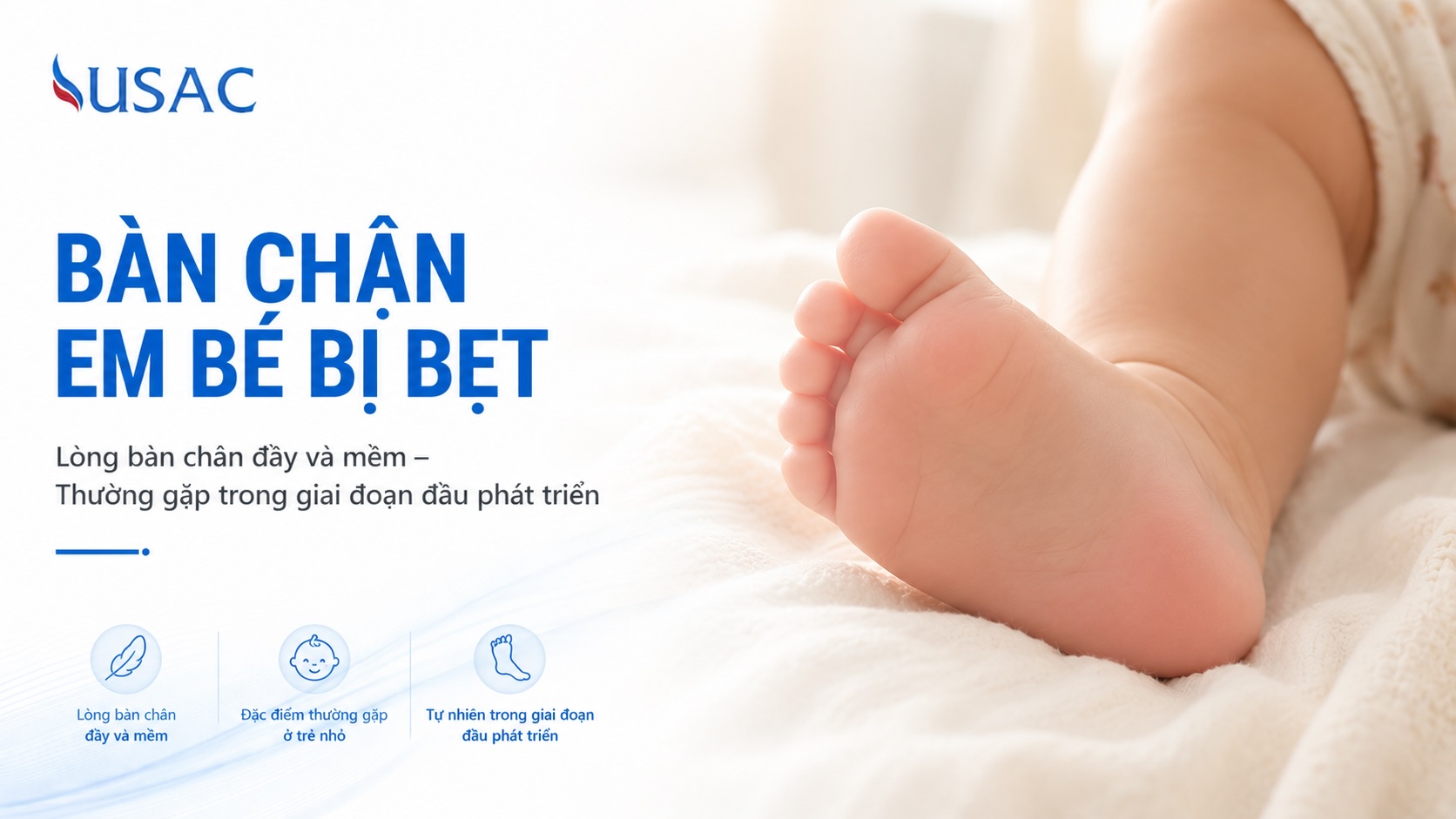 Bàn Chân Em Bé Bị Bẹt