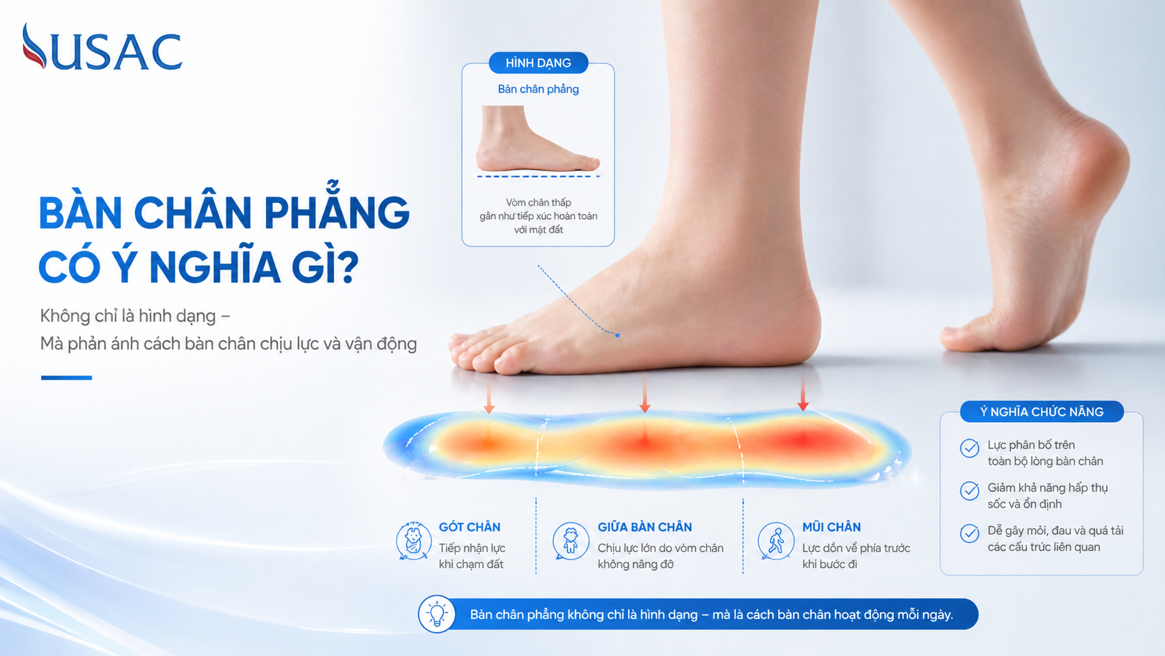 Bàn Chân Phẳng Có Ý Nghĩa Gì