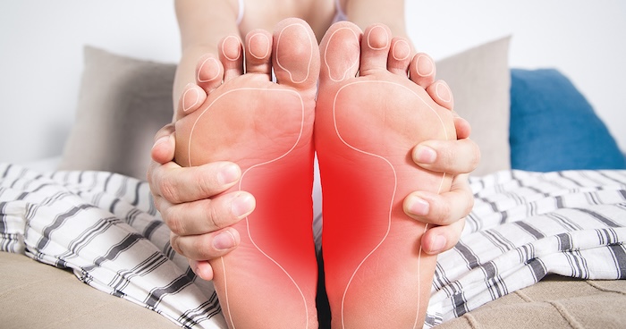 Bàn Chân Phẳng Là Gì