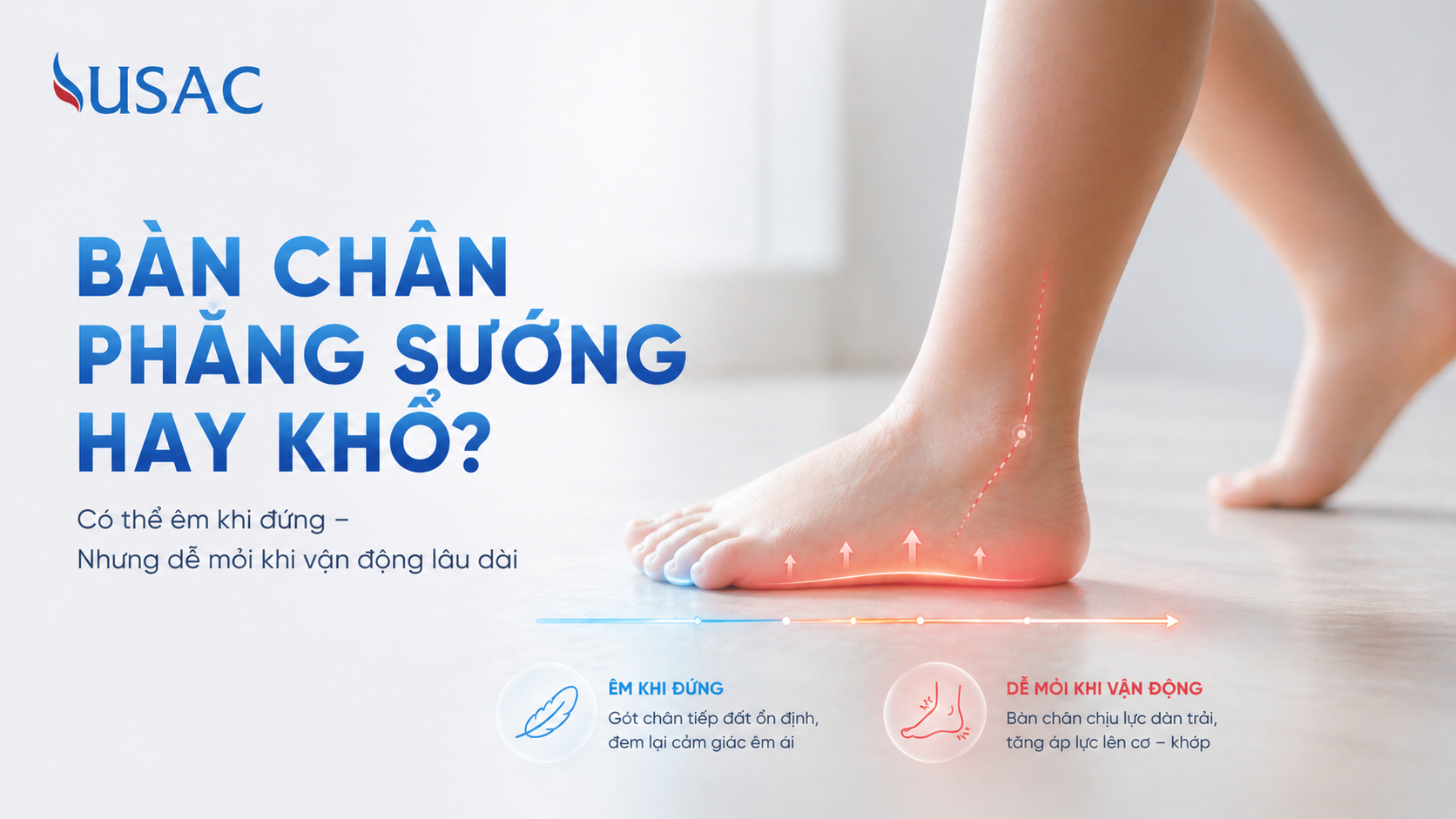 Bàn Chân Phẳng Sướng Hay Khổ