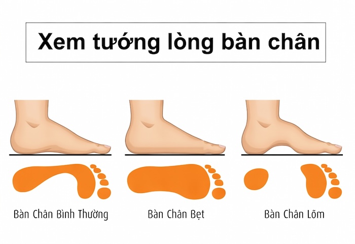 Bàn Chân Phẳng Tướng Số