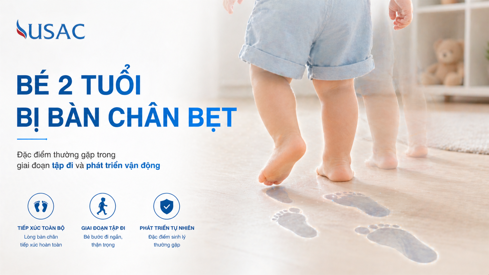 Bé 2 Tuổi Bị Bàn Chân Bẹt