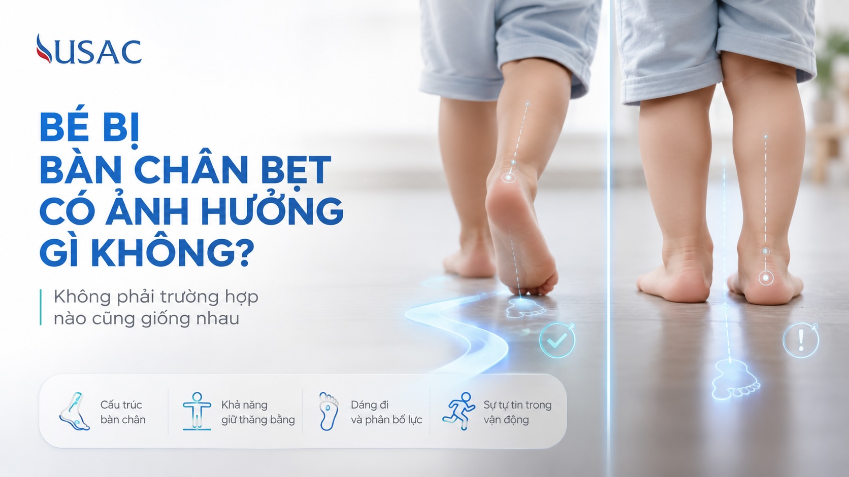 Bé Bị Bàn Chân Bẹt Có Ảnh Hưởng Gì Không