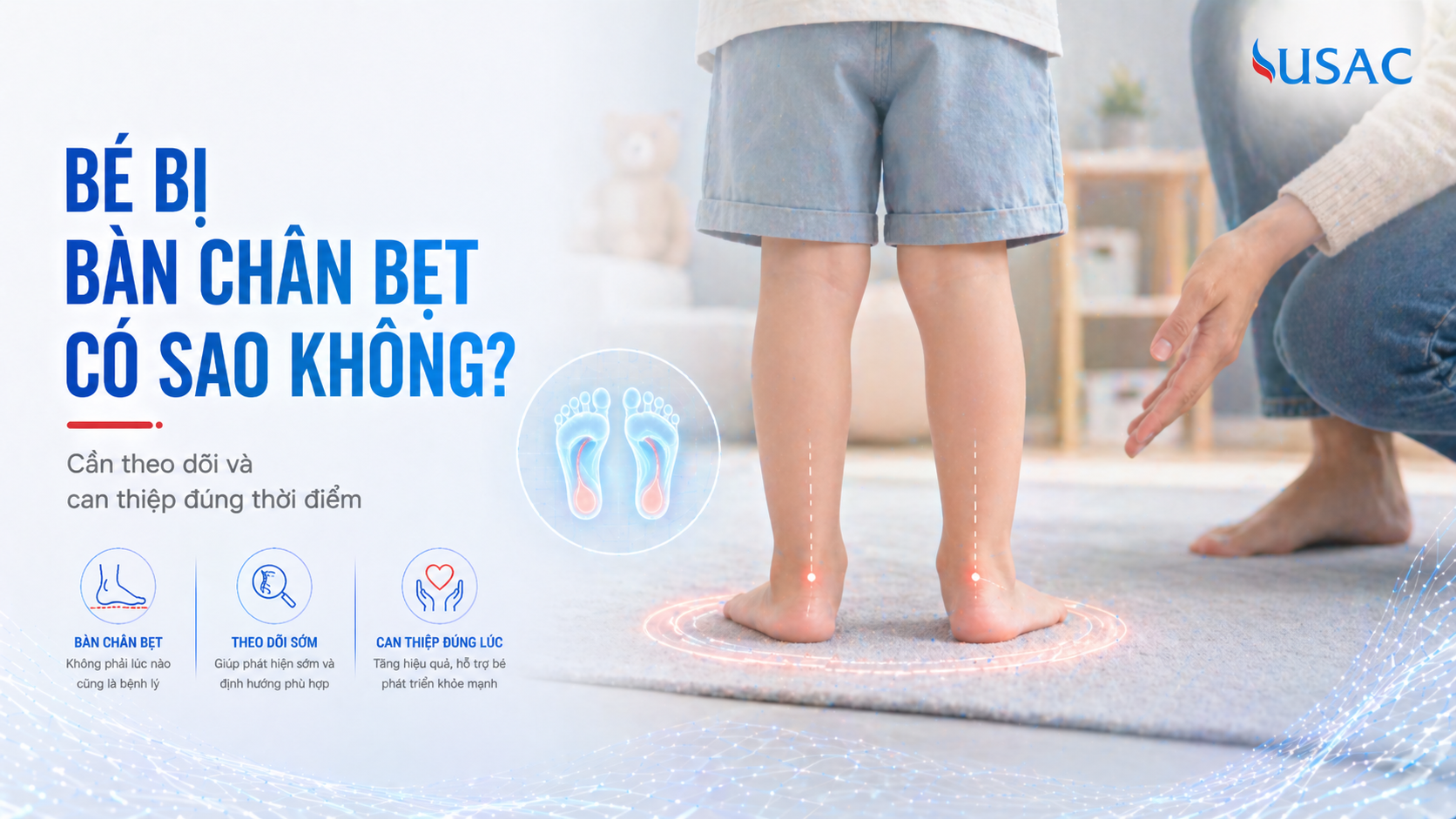 Bé bị bàn chân bẹt có sao không