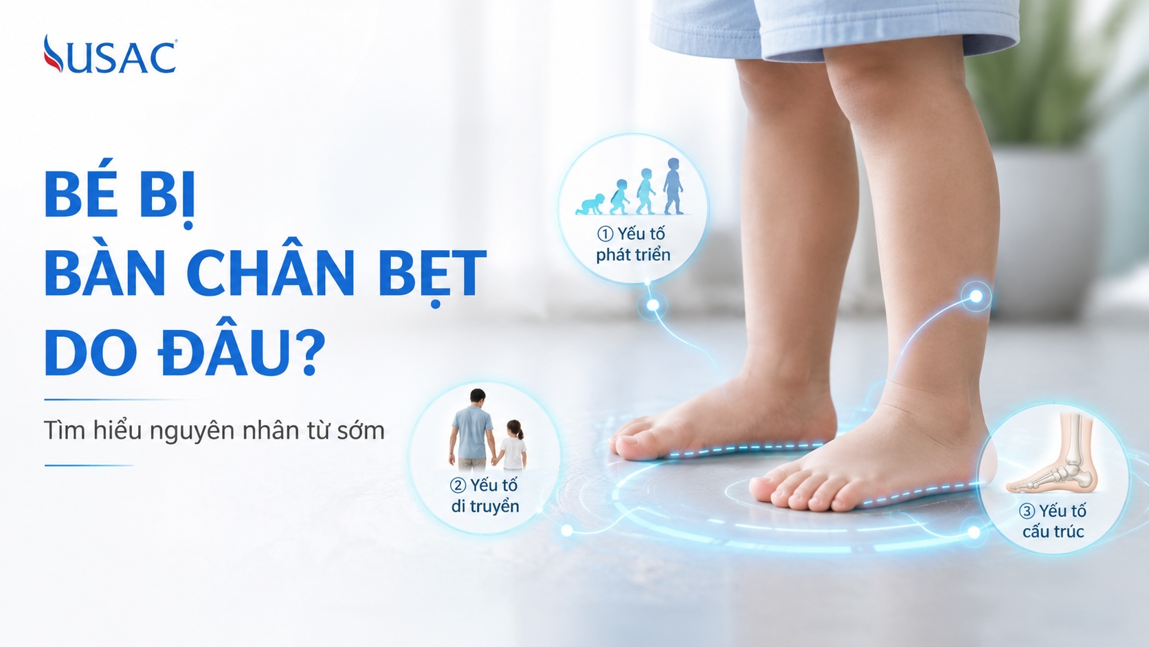 Bé Bị Bàn Chân Bẹt Do Đâu Bé Bị Bàn Chân Bẹt Do Đâu