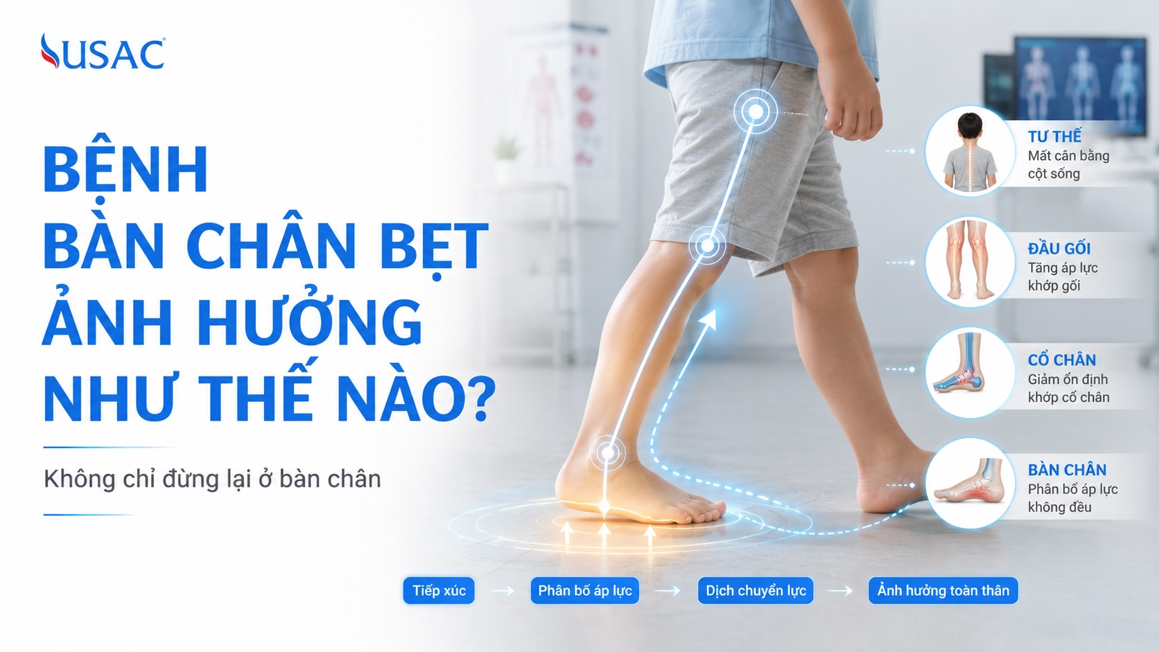 Bệnh Bàn Chân Bẹt Ảnh Hưởng Như Thế Nào