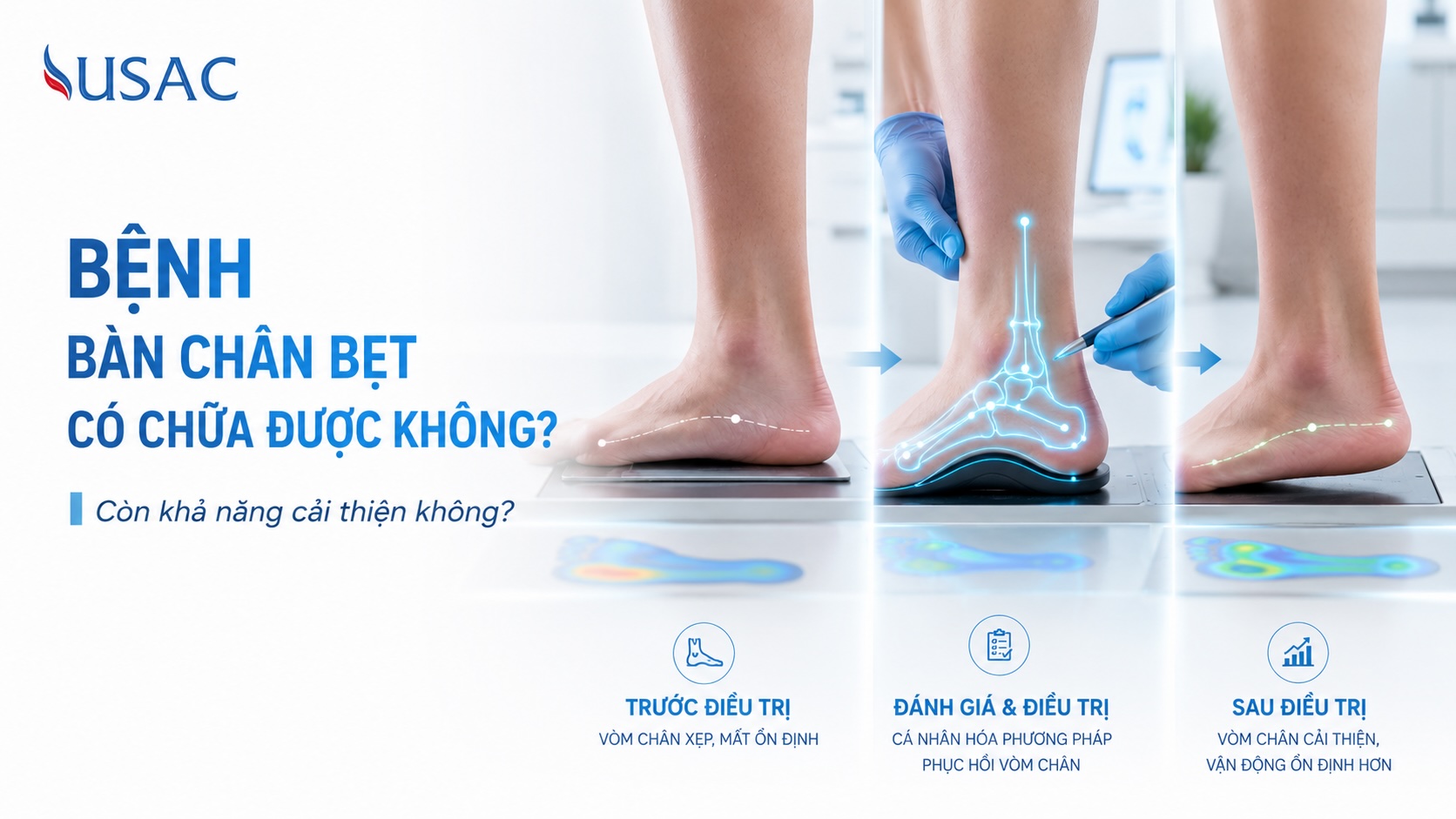 Bệnh Bàn Chân Bẹt Có Chữa Được Không Bệnh Bàn Chân Bẹt Có Chữa Được Không