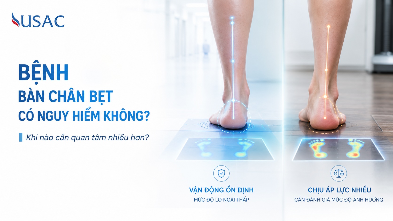 Bệnh Bàn Chân Bẹt Có Nguy Hiểm Không Bệnh Bàn Chân Bẹt Có Nguy Hiểm Không