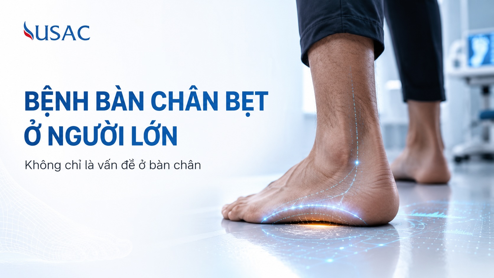 Bệnh Bàn Chân Bẹt Ở Người Lớn Bệnh Bàn Chân Bẹt Ở Người Lớn