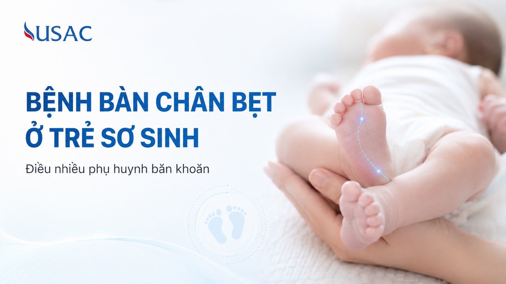 Bệnh Bàn Chân Bẹt Ở Trẻ Sơ Sinh Bệnh Bàn Chân Bẹt Ở Trẻ Sơ Sinh