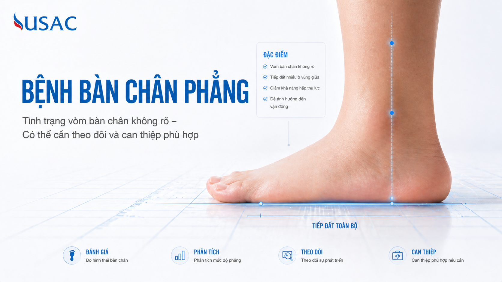 Bệnh Bàn Chân Phẳng Bệnh Bàn Chân Phẳng