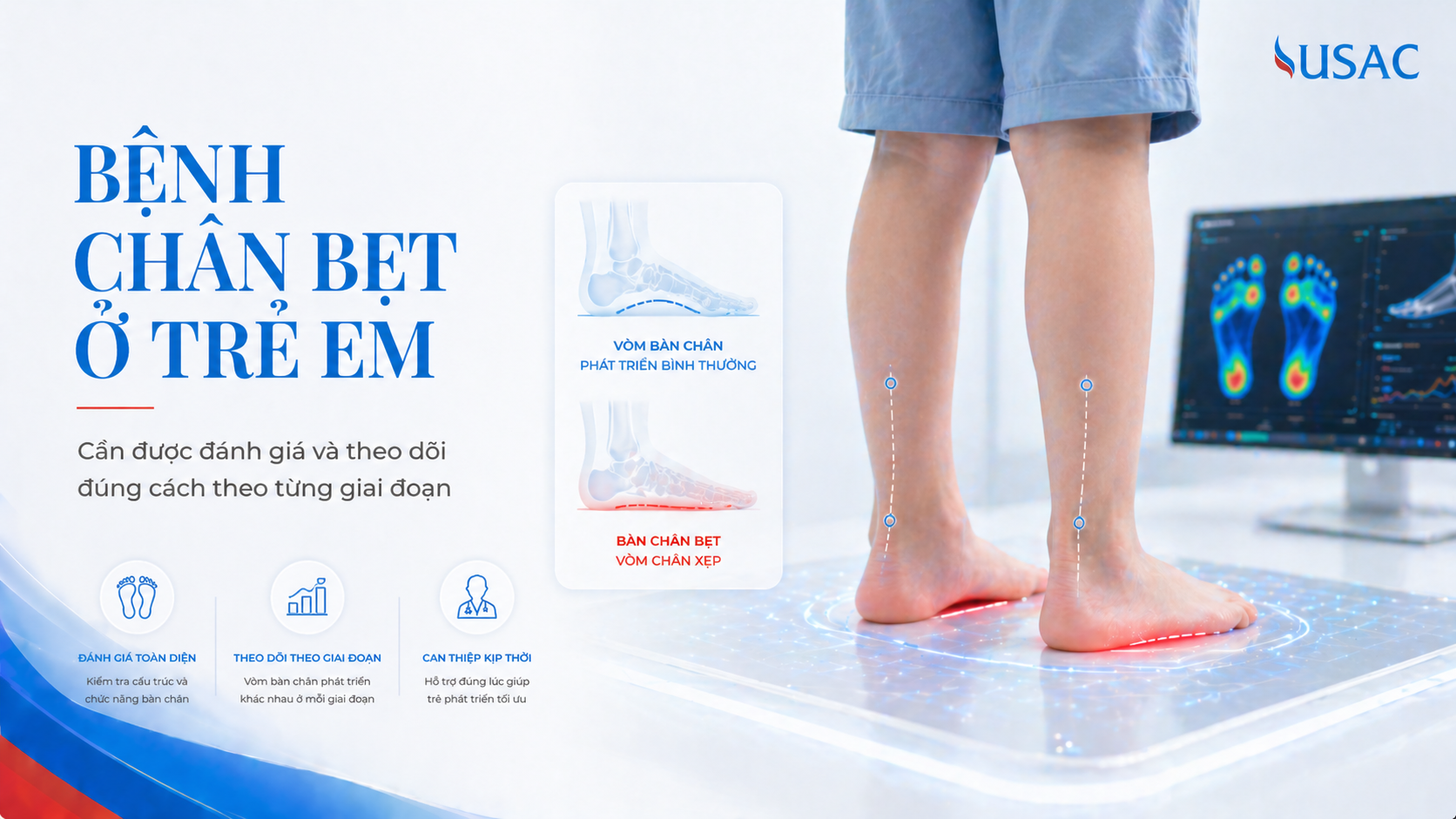 Bệnh Chân Bẹt Ở Trẻ Em
