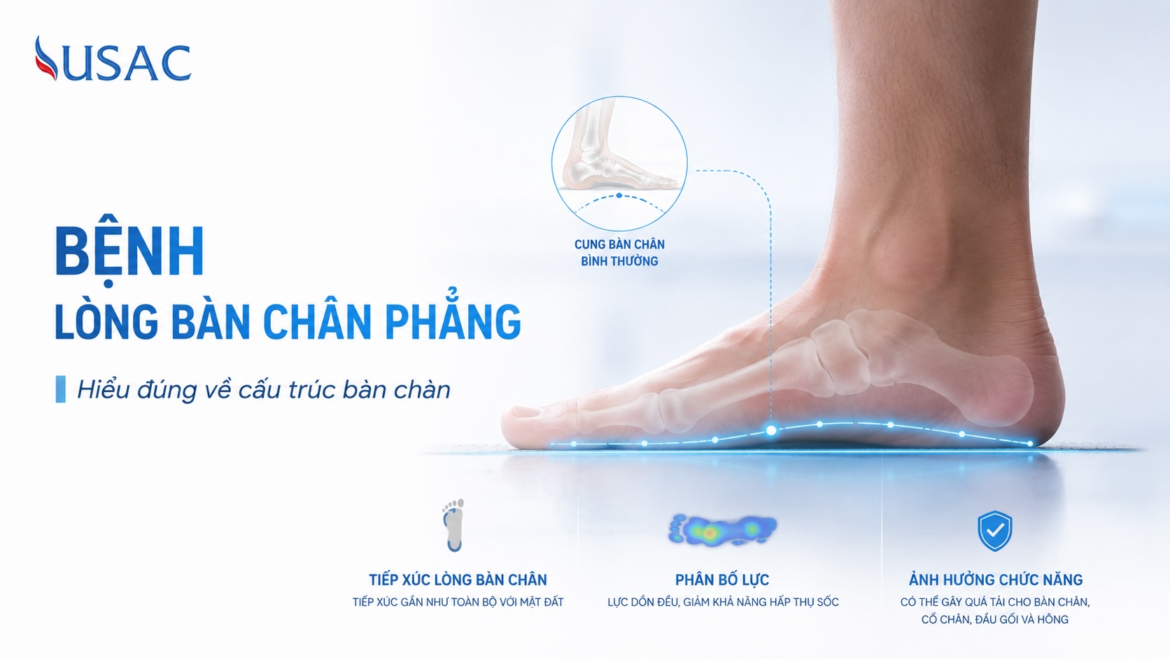 Bệnh Lòng Bàn Chân Phẳng Bệnh Lòng Bàn Chân Phẳng