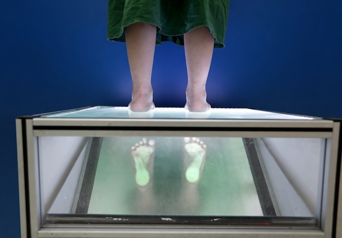 Bệnh Viện Chữa Bàn Chân Bẹt