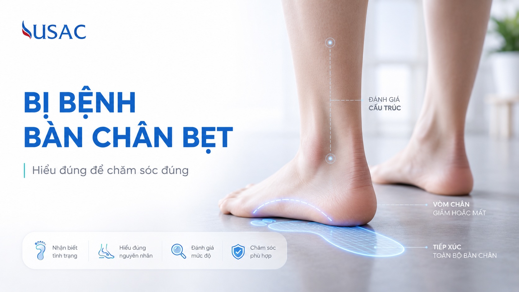 Bị Bệnh Bàn Chân Bẹt Bị Bệnh Bàn Chân Bẹt