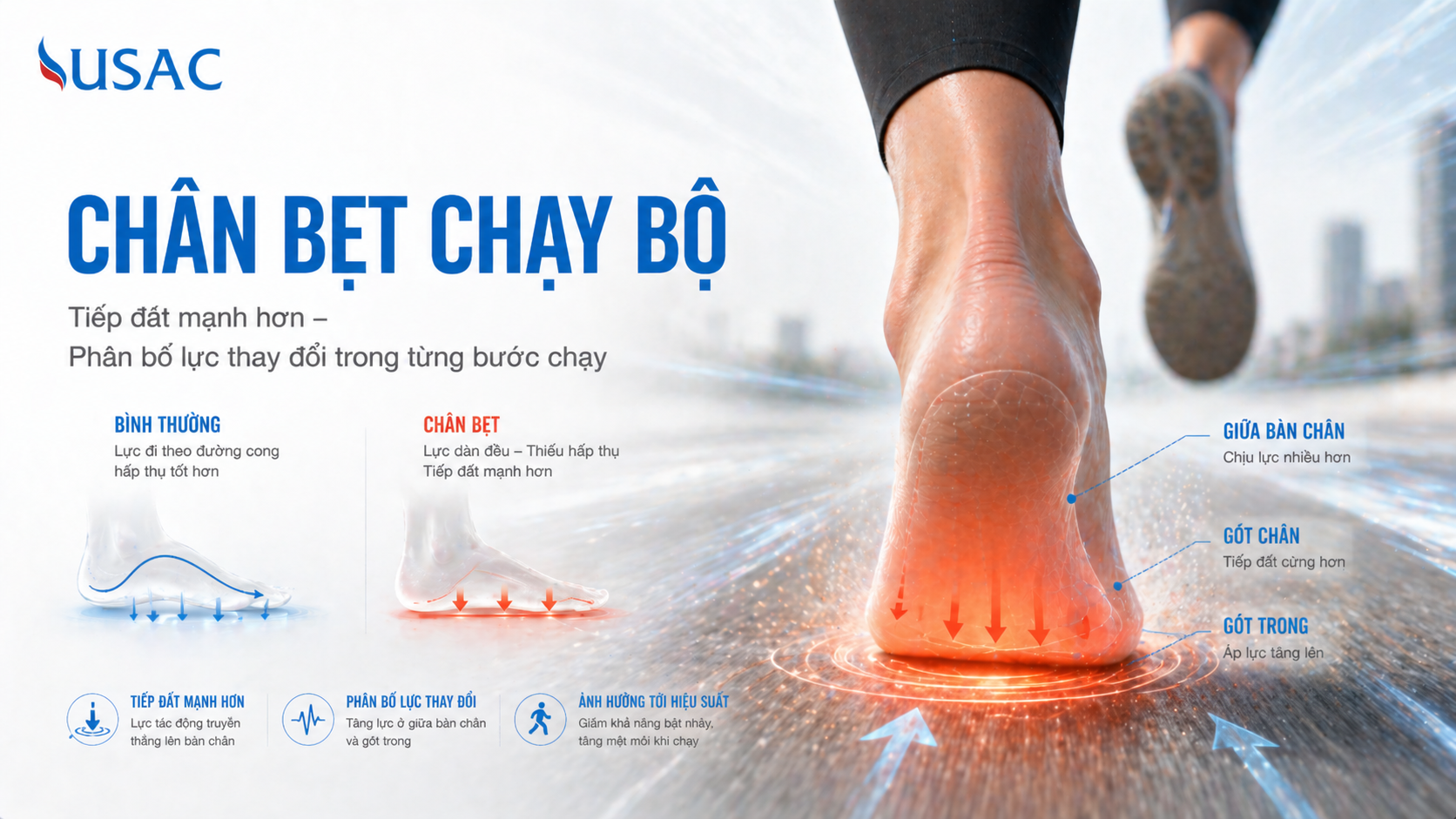 Chân Bẹt Chạy Bộ Chân Bẹt Chạy Bộ