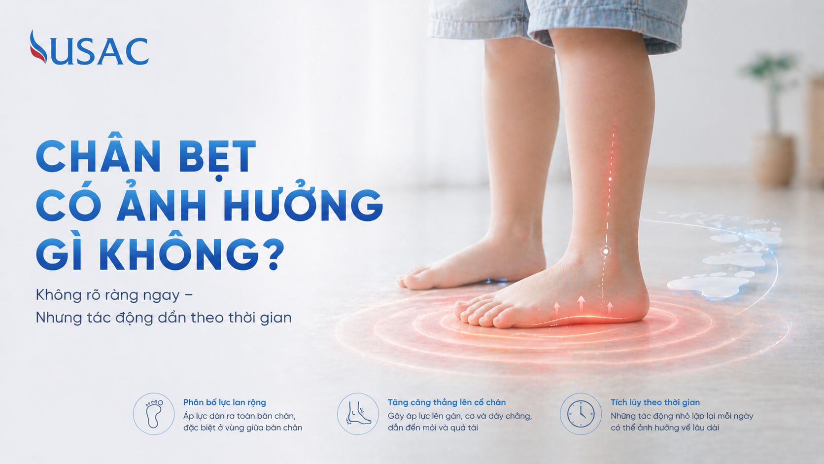 Chân Bẹt Có Ảnh Hưởng Gì Không