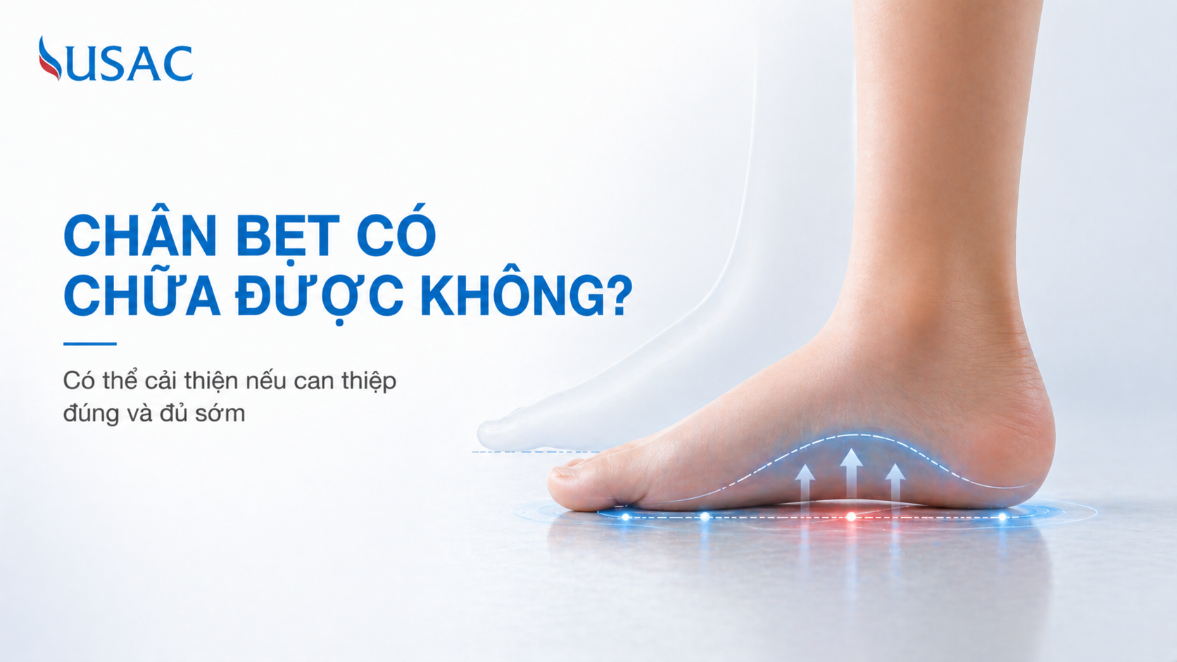 Chân Bẹt Có Chữa Được Không
