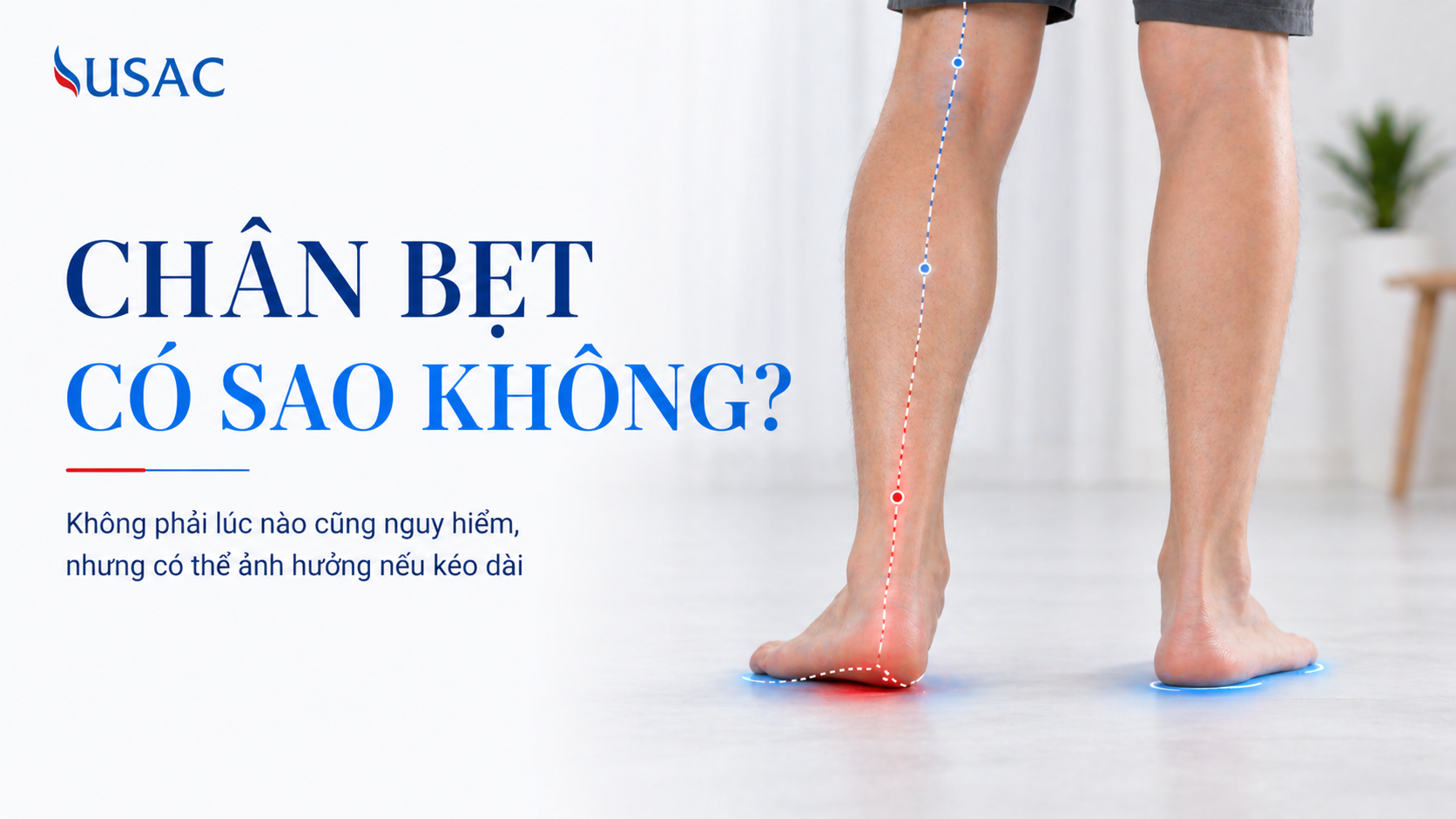 Chân Bẹt Có Sao Không