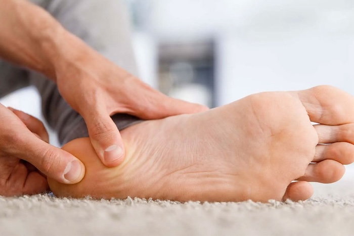 Chân Bị Bẹt Là Sao