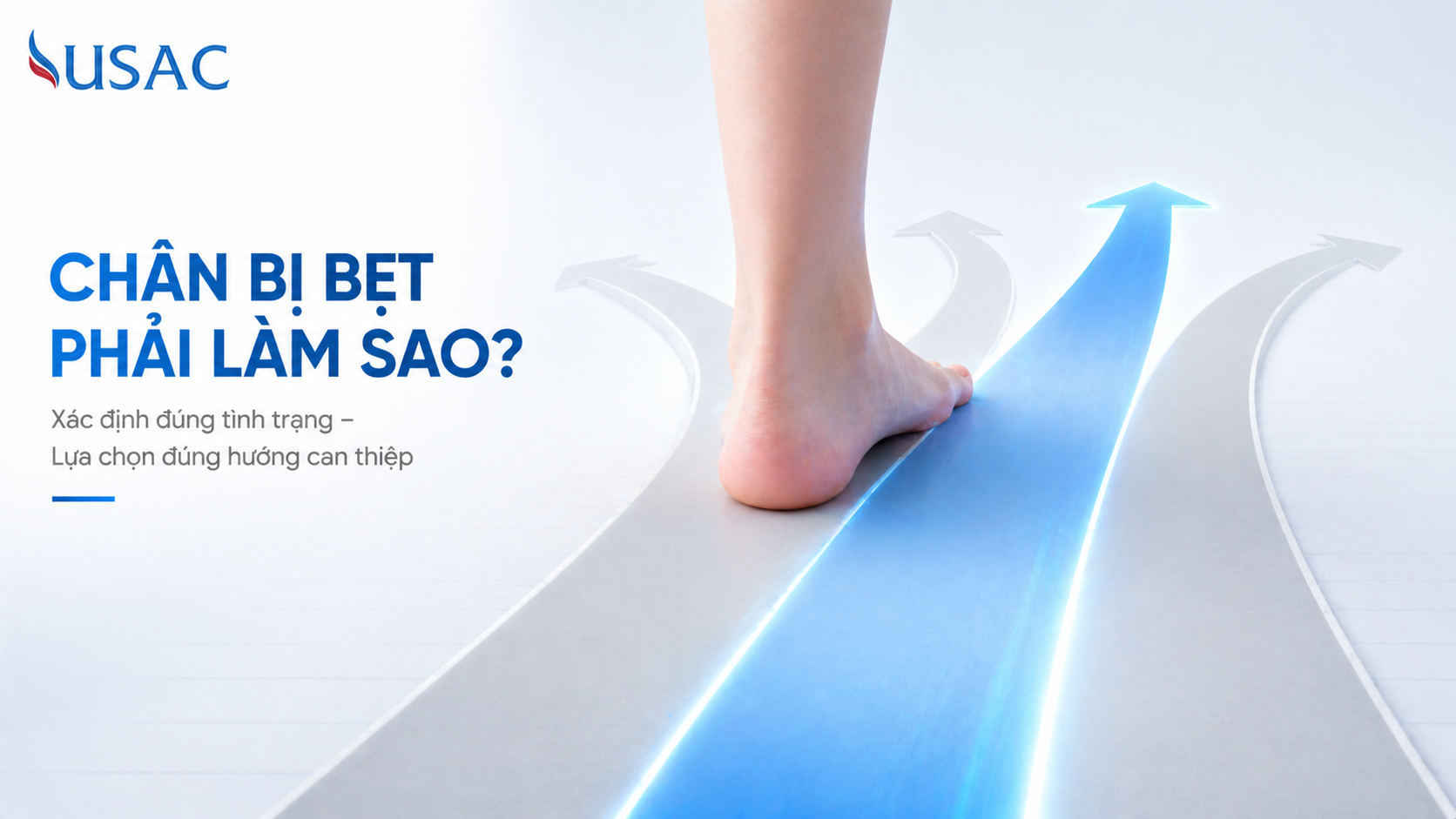 Chân Bị Bẹt Phải Làm Sao Chân Bị Bẹt Phải Làm Sao