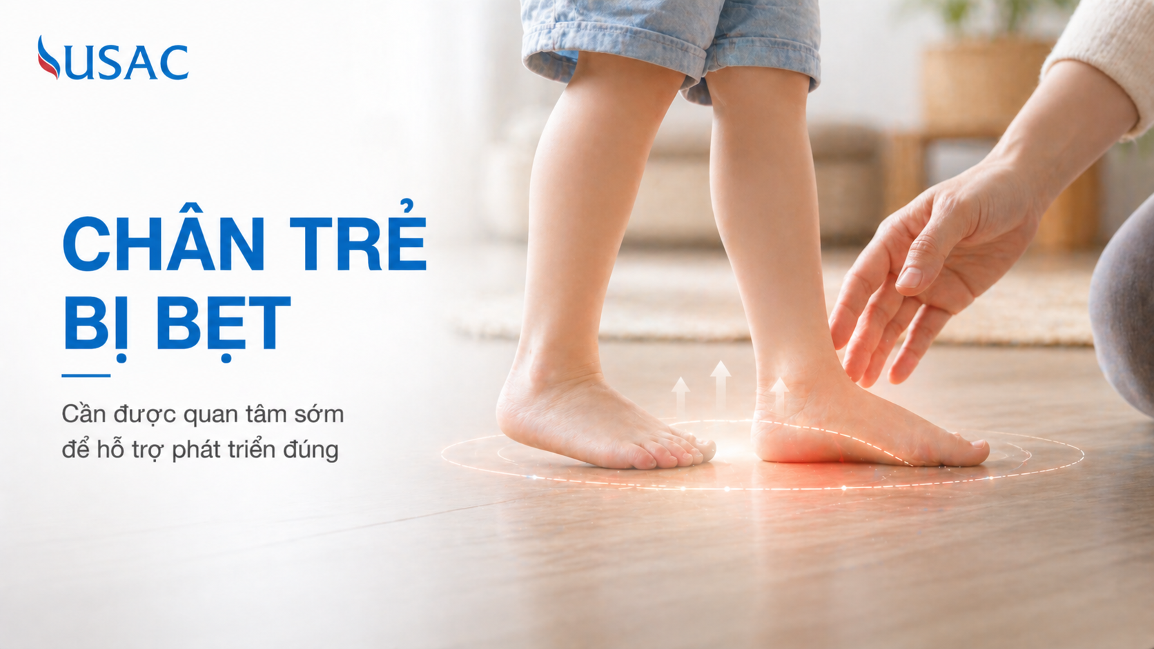 Chân Trẻ Bị Bẹt Chân Trẻ Bị Bẹt