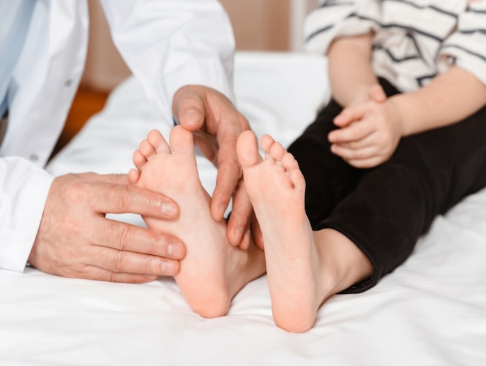 Chi Phí Khám Bàn Chân Bẹt Ở Hà Nội