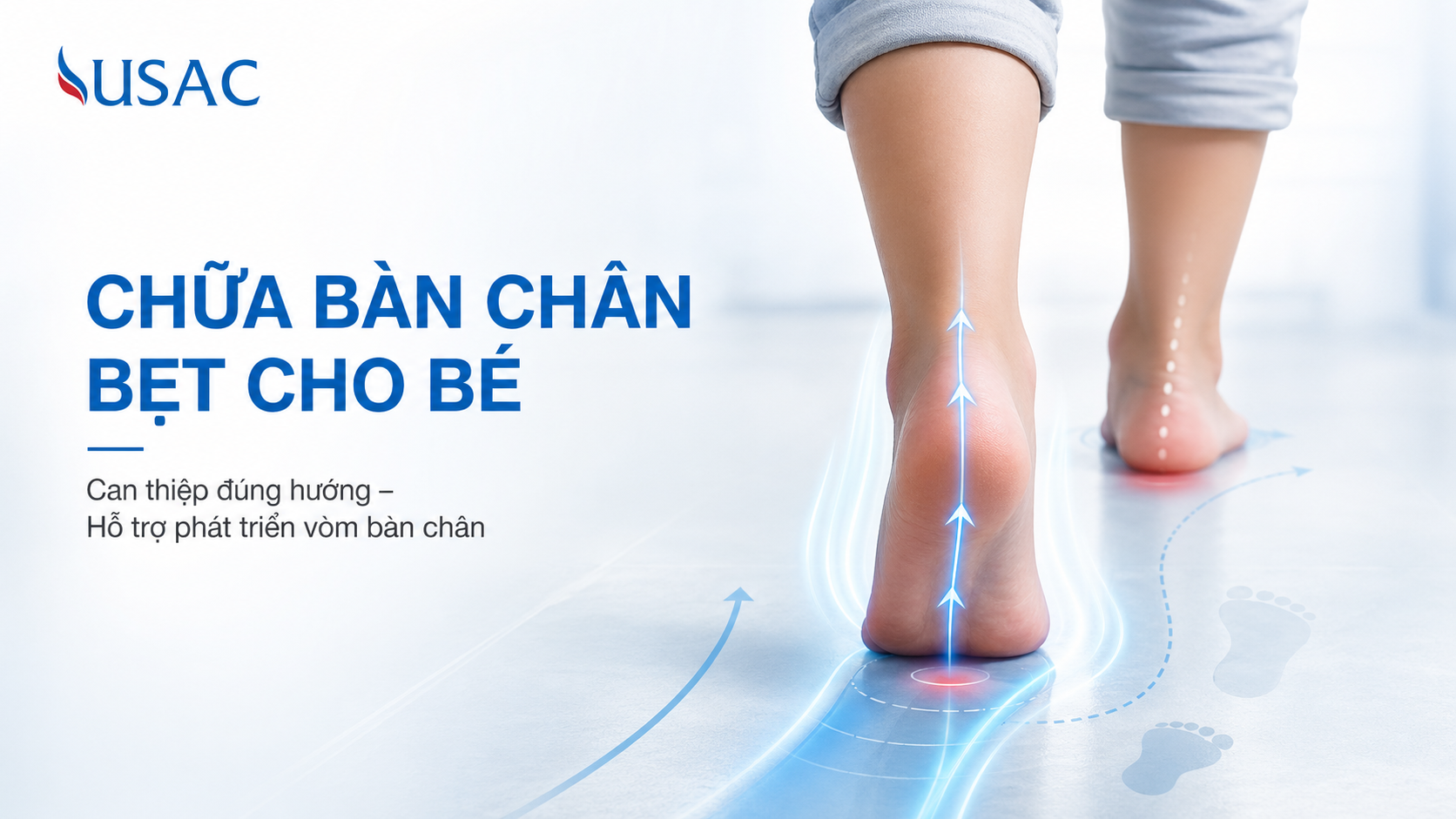 Chữa Bàn Chân Bẹt Cho Bé