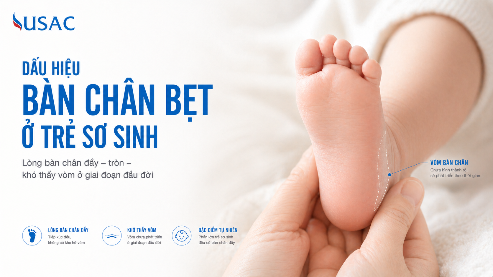 Dấu Hiệu Bàn Chân Bẹt Ở Trẻ Sơ Sinh