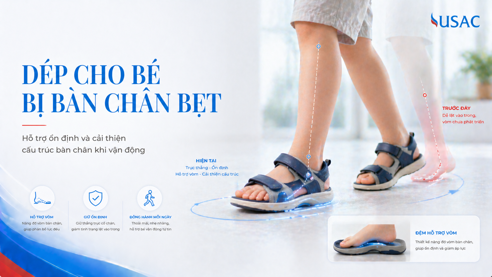 Dép Cho Bé Bị Bàn Chân Bẹt