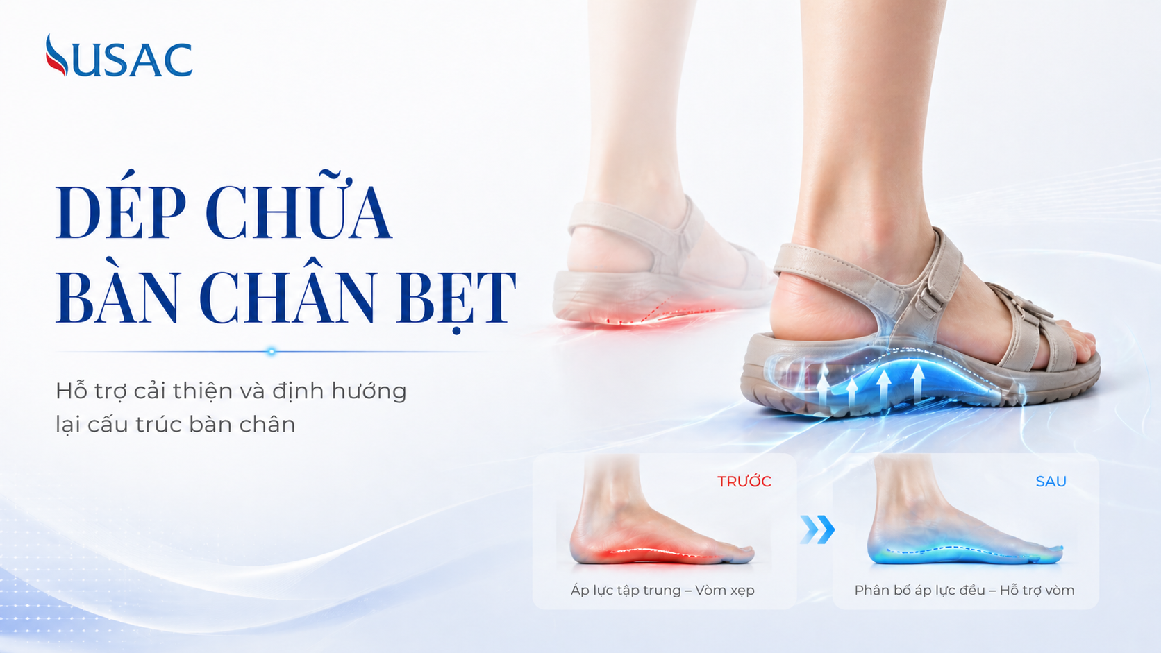 Dép Chữa Bàn Chân Bẹt