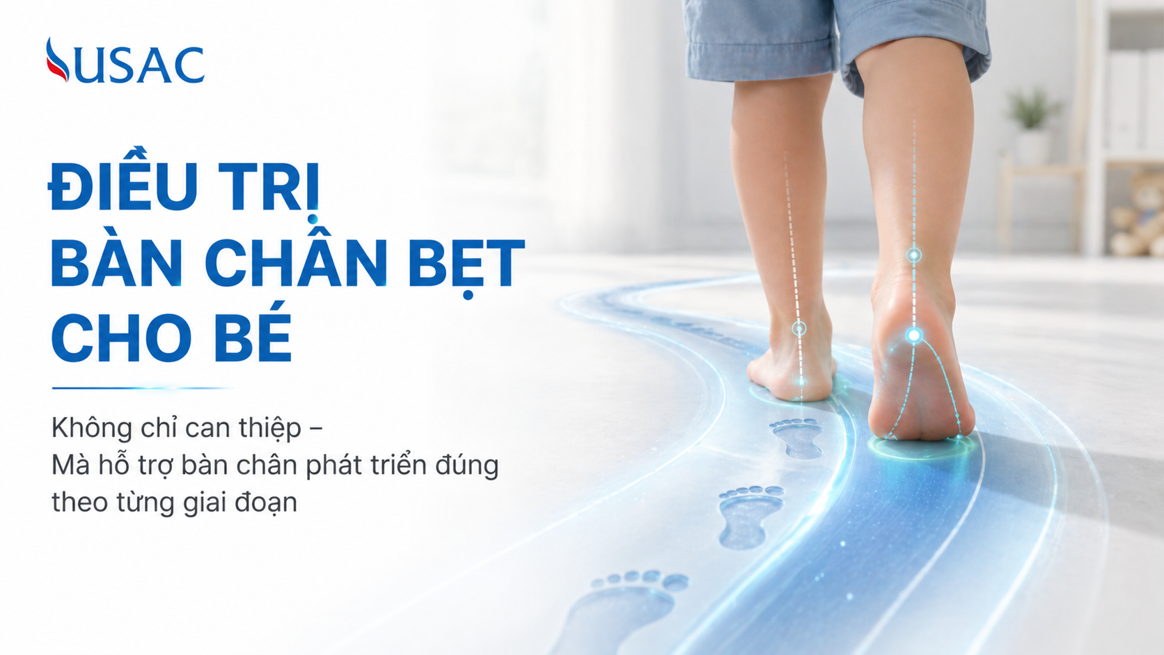 Điều Trị Bàn Chân Bẹt Cho Bé Điều Trị Bàn Chân Bẹt Cho Bé