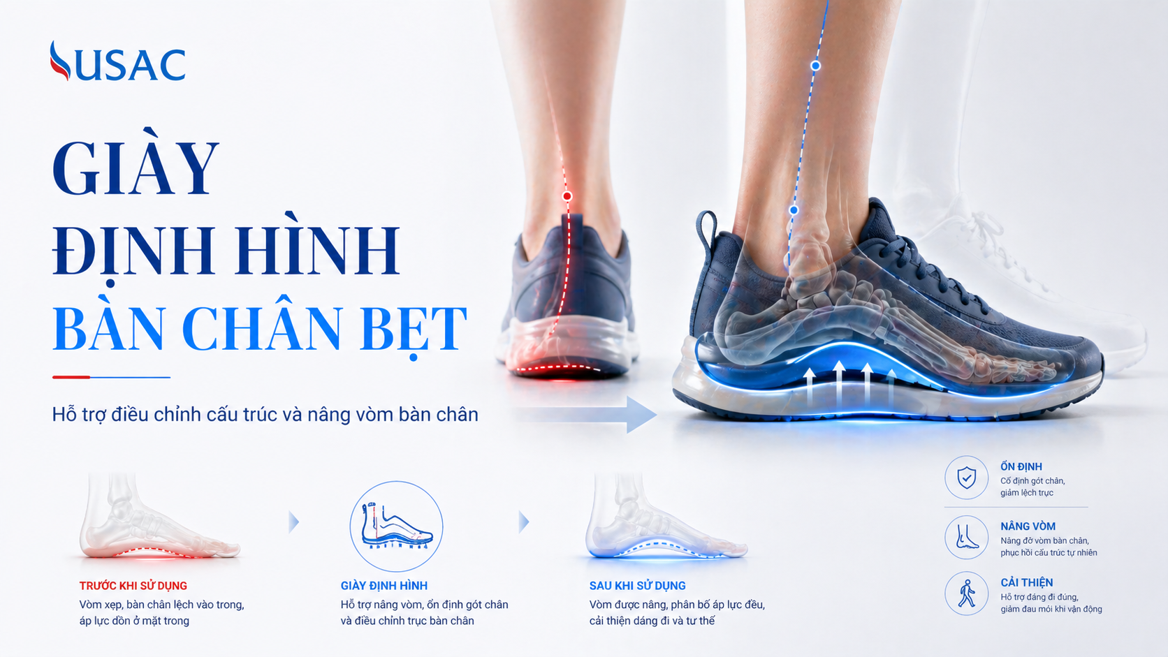 Giày Định Hình Bàn Chân Bẹt