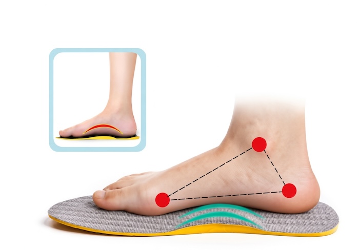 Giày Hỗ Trợ Bàn Chân Bẹt