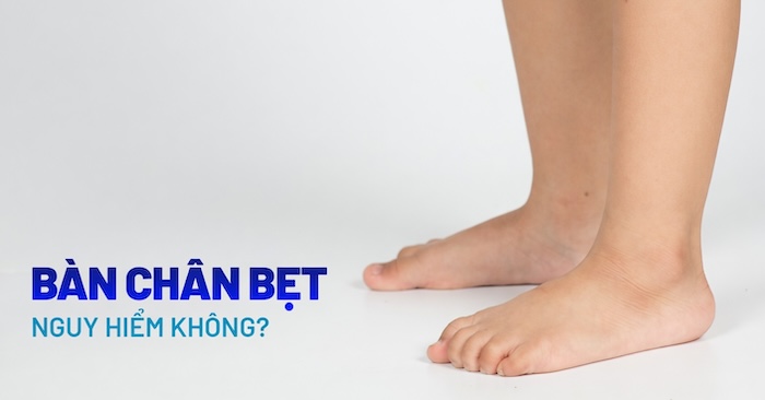 Hội Chứng Bàn Chân Bẹt Có Nguy Hiểm Không